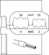Module insert for conductor end-sleeves 50/35mm - 1830627 (1) (Thumbnail)